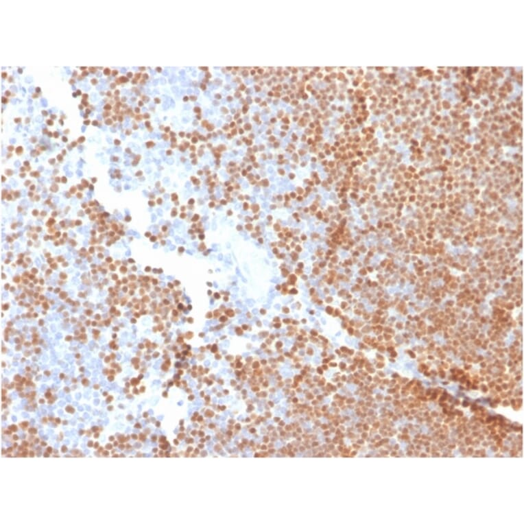 Immunohistochemistry - Anti-TdT Antibody [DNTT/1453] - BSA and Azide free (A251531) - Antibodies.com