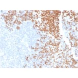 Immunohistochemistry - Anti-TdT Antibody [DNTT/1453] - BSA and Azide free (A251531) - Antibodies.com