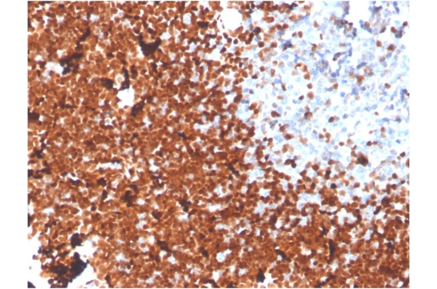 Immunohistochemistry - Anti-TdT Antibody [DNTT/1453] - BSA and Azide free (A251530) - Antibodies.com