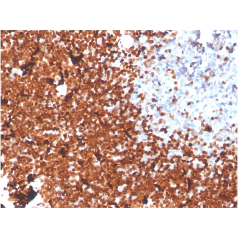 Immunohistochemistry - Anti-TdT Antibody [DNTT/1453] - BSA and Azide free (A251530) - Antibodies.com
