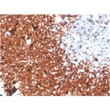 Immunohistochemistry - Anti-TdT Antibody [DNTT/1453] - BSA and Azide free (A251530) - Antibodies.com