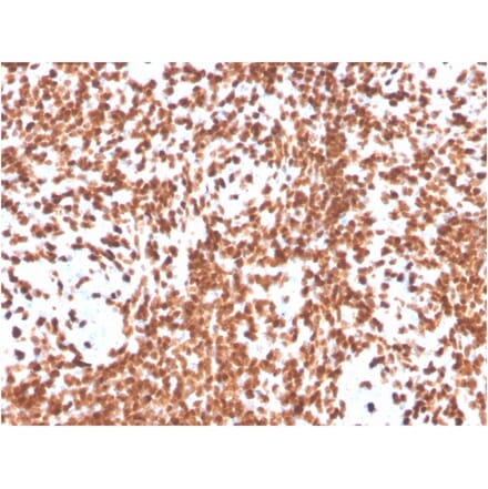 Immunohistochemistry - Anti-TdT Antibody [DNTT/4506R] - BSA and Azide free (A251532) - Antibodies.com