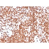 Immunohistochemistry - Anti-TdT Antibody [DNTT/4506R] - BSA and Azide free (A251532) - Antibodies.com