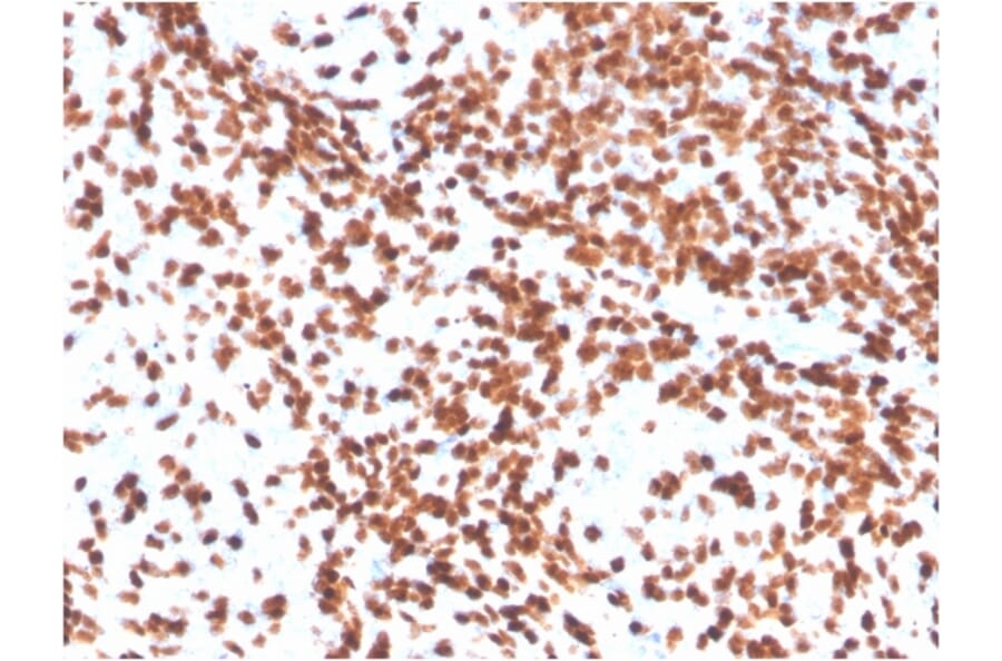 Immunohistochemistry - Anti-TdT Antibody [DNTT/4506R] - BSA and Azide free (A251531) - Antibodies.com