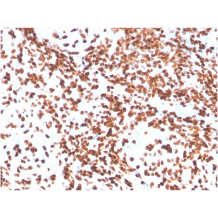 Immunohistochemistry - Anti-TdT Antibody [DNTT/4506R] - BSA and Azide free (A251531) - Antibodies.com