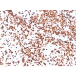 Immunohistochemistry - Anti-TdT Antibody [DNTT/4506R] - BSA and Azide free (A251531) - Antibodies.com
