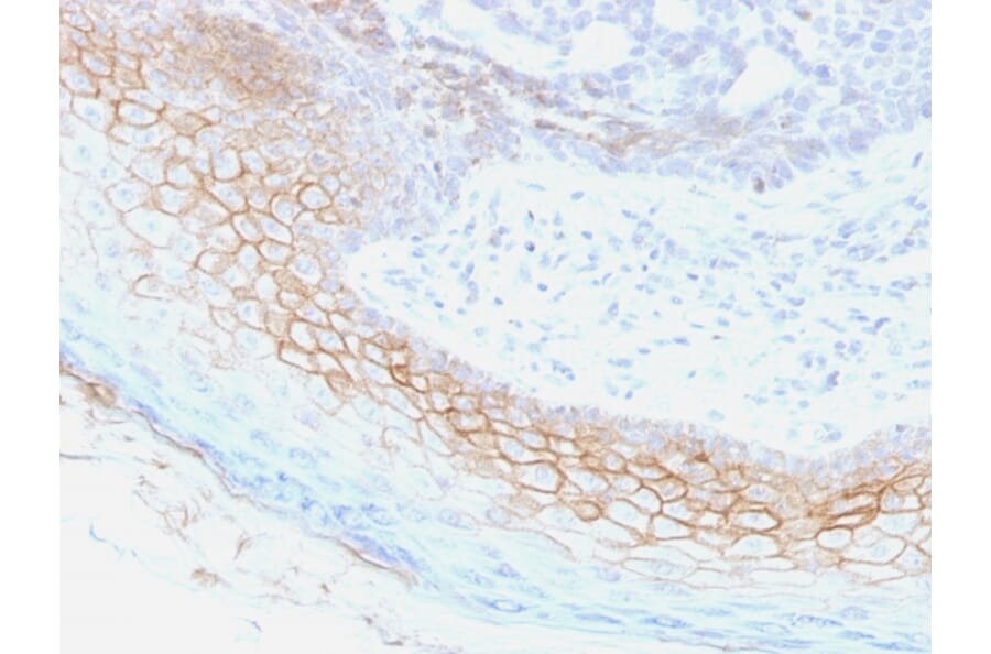 Immunohistochemistry - Anti-Desmocollin 2 Antibody [7G6] - BSA and Azide free (A251536) - Antibodies.com