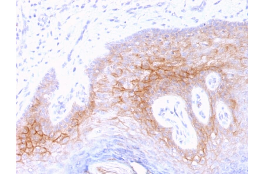 Immunohistochemistry - Anti-Desmocollin 2 Antibody [7G6] - BSA and Azide free (A251532) - Antibodies.com