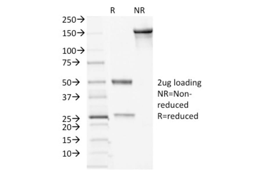 SDS-PAGE - Anti-Desmocollin 2 Antibody [7G6] - BSA and Azide free (A251536) - Antibodies.com