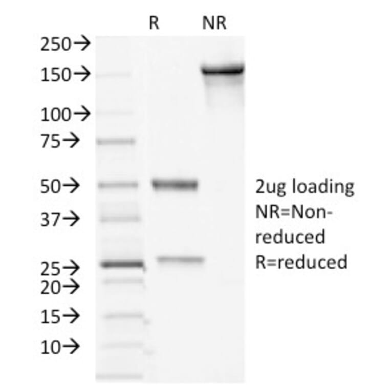 SDS-PAGE - Anti-Desmocollin 2 Antibody [7G6] - BSA and Azide free (A251536) - Antibodies.com