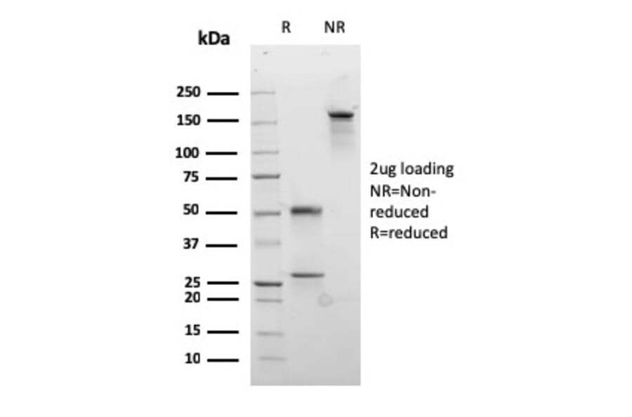 SDS-PAGE - Anti-Desmocollin 2 Antibody [rDSC2/3437] - BSA and Azide free (A251536) - Antibodies.com