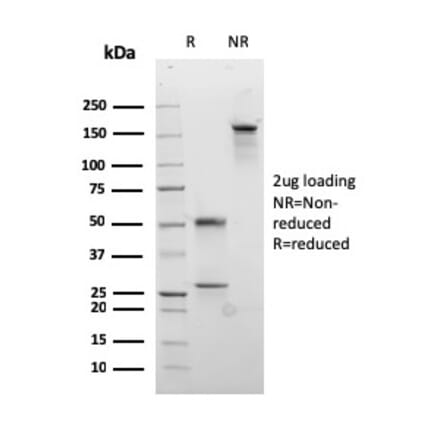 SDS-PAGE - Anti-Desmocollin 2 Antibody [rDSC2/3437] - BSA and Azide free (A251536) - Antibodies.com