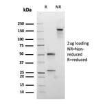 SDS-PAGE - Anti-Desmocollin 2 Antibody [rDSC2/3437] - BSA and Azide free (A251536) - Antibodies.com