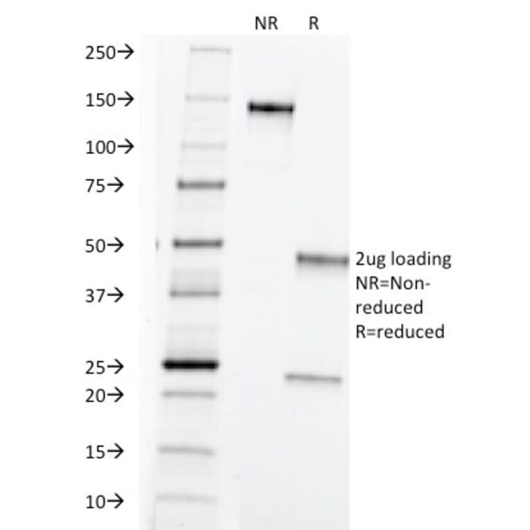 SDS-PAGE - Anti-TAG72 Antibody [B72.3] - BSA and Azide free (A251538) - Antibodies.com