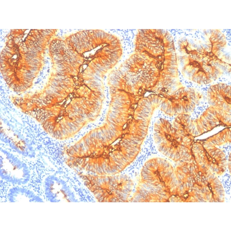 Immunohistochemistry - Anti-TAG72 Antibody [SPM148] - BSA and Azide free (A251538) - Antibodies.com