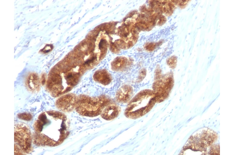 Immunohistochemistry - Anti-TAG72 Antibody [CC49] - BSA and Azide free (A251540) - Antibodies.com