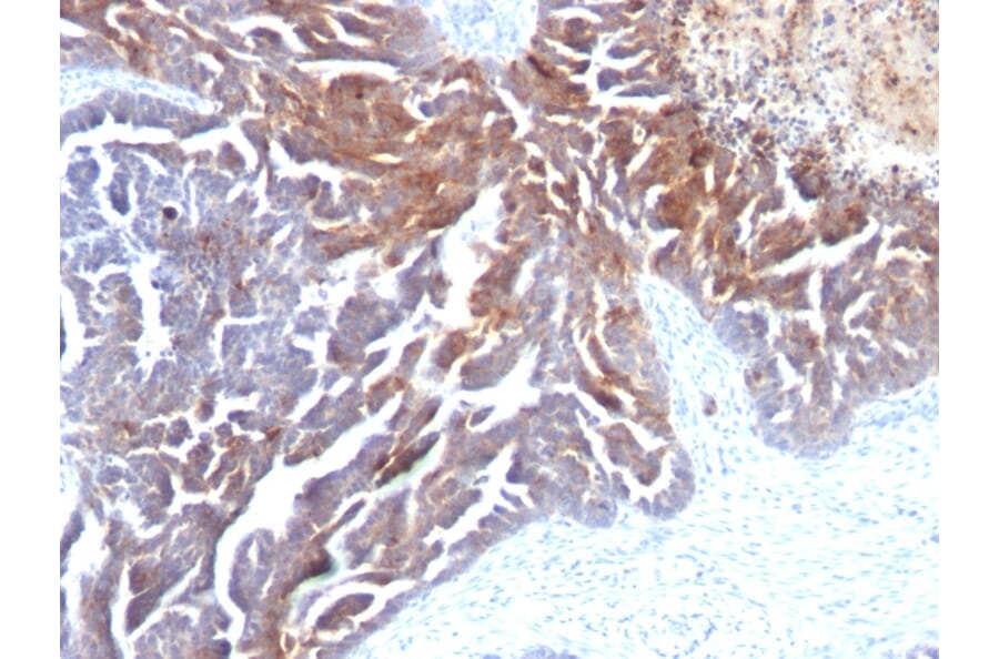 Immunohistochemistry - Anti-TAG72 Antibody [CC49] - BSA and Azide free (A251539) - Antibodies.com