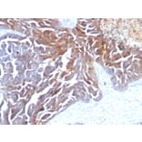 Immunohistochemistry - Anti-TAG72 Antibody [CC49] - BSA and Azide free (A251539) - Antibodies.com