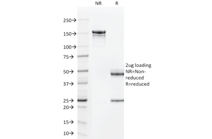 SDS-PAGE - Anti-TAG72 Antibody [CC49] - BSA and Azide free (A251540) - Antibodies.com