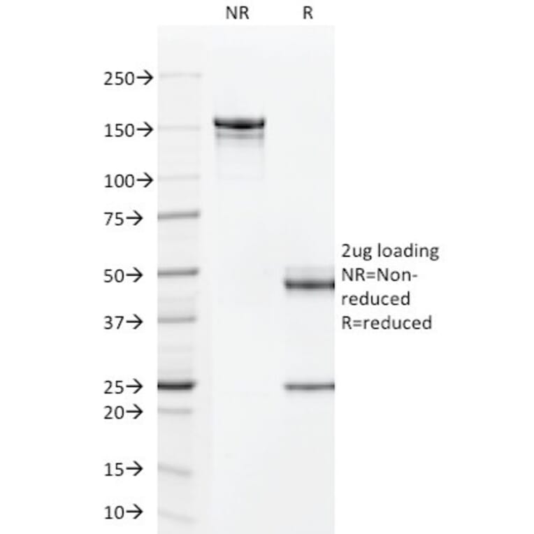 SDS-PAGE - Anti-TAG72 Antibody [CC49] - BSA and Azide free (A251540) - Antibodies.com