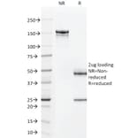 SDS-PAGE - Anti-TAG72 Antibody [CC49] - BSA and Azide free (A251540) - Antibodies.com