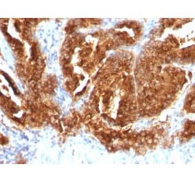 Immunohistochemistry - Anti-TAG72 Antibody [CA72/733] - BSA and Azide free (A251542) - Antibodies.com