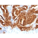 Immunohistochemistry - Anti-TAG72 Antibody [CA72/733] - BSA and Azide free (A251542) - Antibodies.com