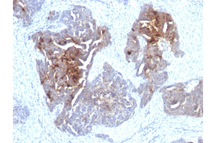 Immunohistochemistry - Anti-TAG72 Antibody [CA72/733] - BSA and Azide free (A251542) - Antibodies.com