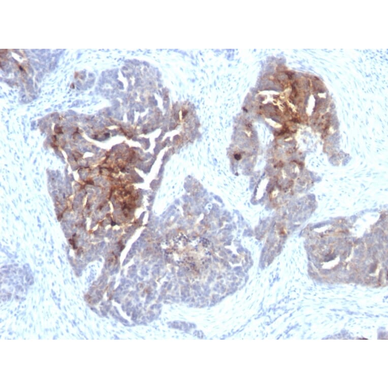 Immunohistochemistry - Anti-TAG72 Antibody [CA72/733] - BSA and Azide free (A251542) - Antibodies.com