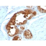 Immunohistochemistry - Anti-TAG72 Antibody [B72.3 + CA72/733] - BSA and Azide free (A251543) - Antibodies.com