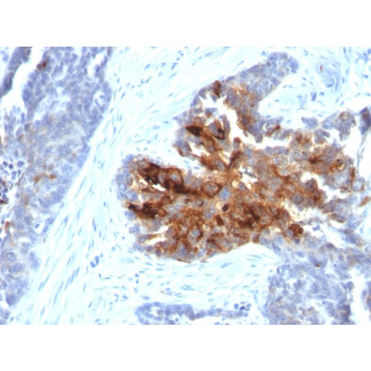 Immunohistochemistry - Anti-TAG72 Antibody [B72.3 + CA72/733] - BSA and Azide free (A251542) - Antibodies.com