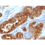 Immunohistochemistry - Anti-TAG72 Antibody [B72.3 + CC49] - BSA and Azide free (A251544) - Antibodies.com