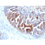 Immunohistochemistry - Anti-TAG72 Antibody [B72.3 + CC49] - BSA and Azide free (A251543) - Antibodies.com