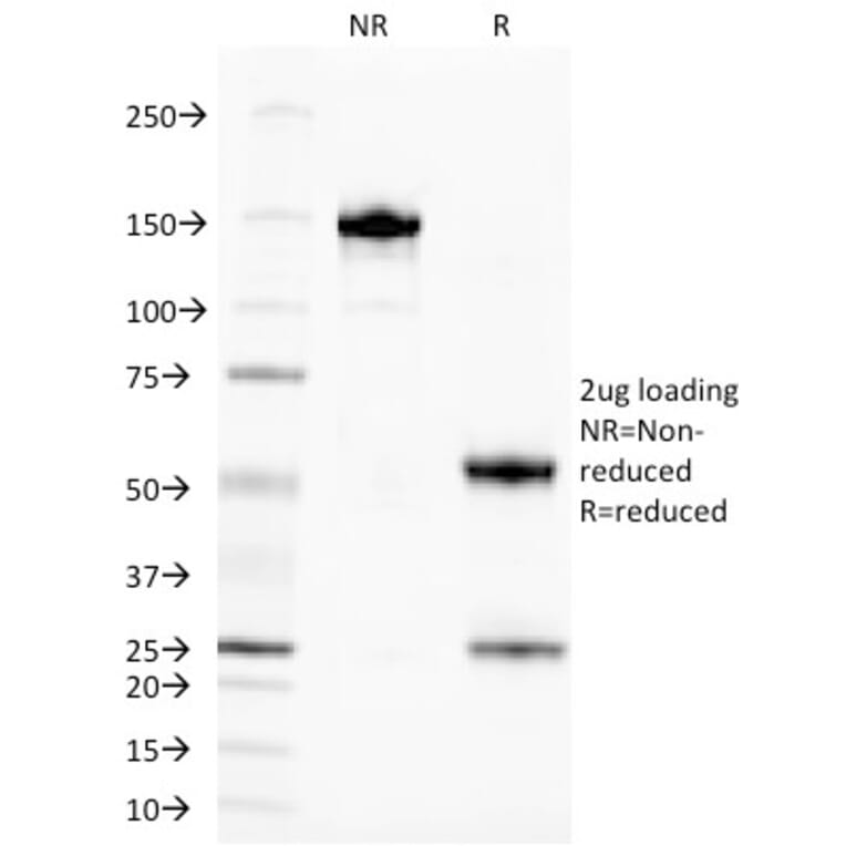 SDS-PAGE - Anti-TAG72 Antibody [CA72/145] - BSA and Azide free (A251544) - Antibodies.com