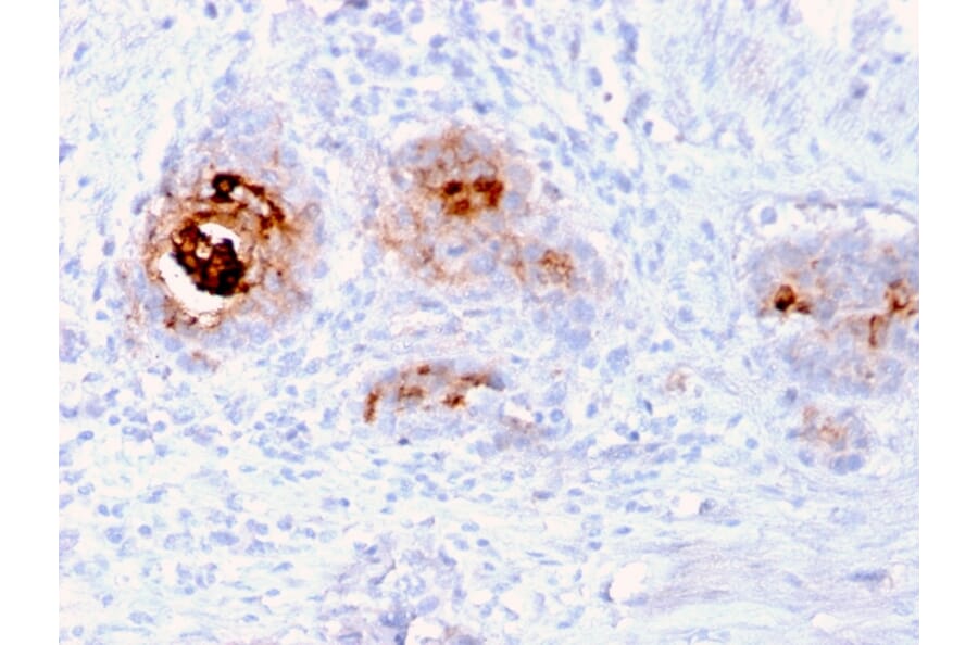 Immunohistochemistry - Anti-TAG72 Antibody [rB72.3] - BSA and Azide free (A251545) - Antibodies.com