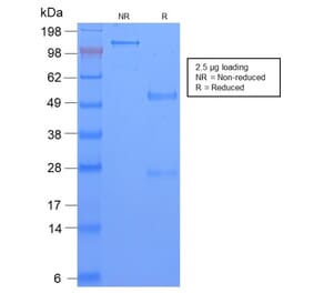 SDS-PAGE - Anti-TAG72 Antibody [CA72/2869R] - BSA and Azide free (A251547) - Antibodies.com