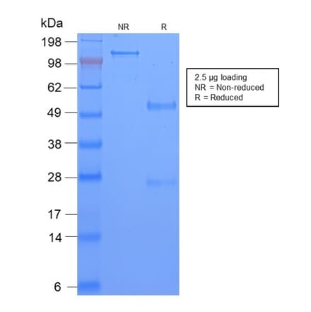 SDS-PAGE - Anti-TAG72 Antibody [CA72/2869R] - BSA and Azide free (A251547) - Antibodies.com