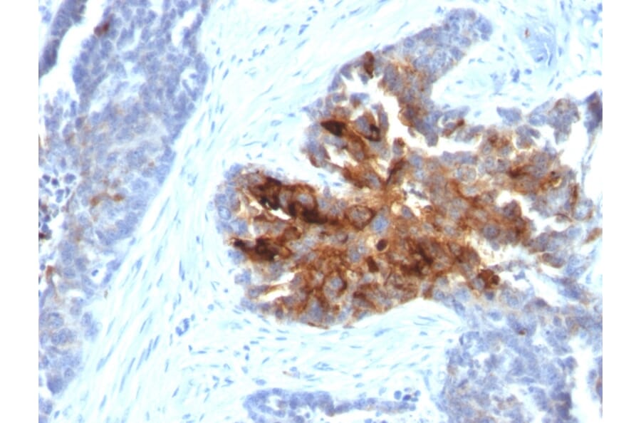 Immunohistochemistry - Anti-TAG72 Antibody [CA72/2869R] - BSA and Azide free (A251546) - Antibodies.com