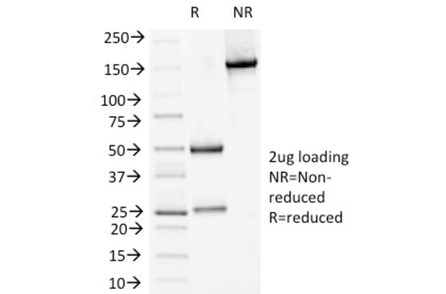 SDS-PAGE - Anti-Desmoglein 1 Antibody [18D4] - BSA and Azide free (A251547) - Antibodies.com