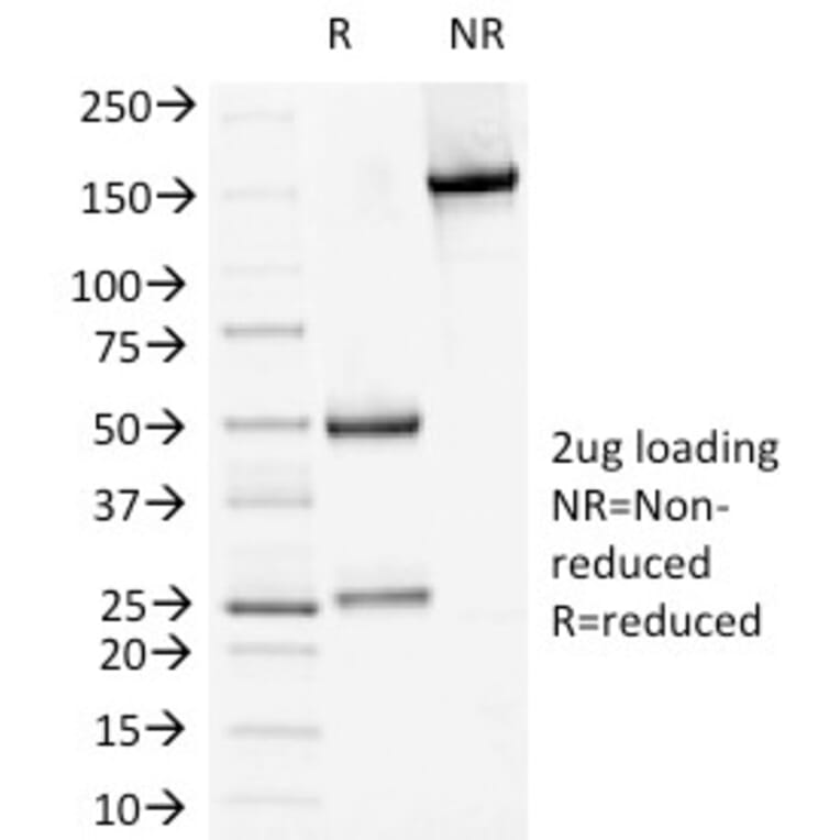 SDS-PAGE - Anti-Desmoglein 1 Antibody [18D4] - BSA and Azide free (A251547) - Antibodies.com