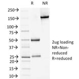 SDS-PAGE - Anti-Desmoglein 1 Antibody [18D4] - BSA and Azide free (A251547) - Antibodies.com