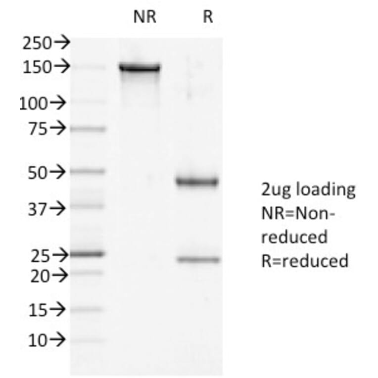 SDS-PAGE - Anti-Desmoglein 1 Antibody [27B2] - BSA and Azide free (A251548) - Antibodies.com