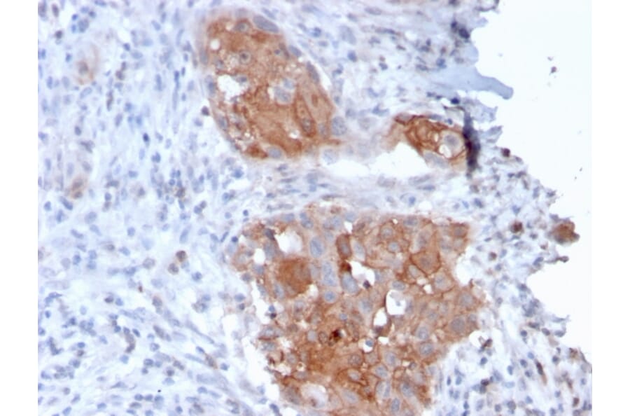 Immunohistochemistry - Anti-Desmoglein 1 Antibody [32-2B] - BSA and Azide free (A251550) - Antibodies.com