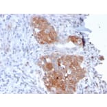 Immunohistochemistry - Anti-Desmoglein 1 Antibody [32-2B] - BSA and Azide free (A251550) - Antibodies.com