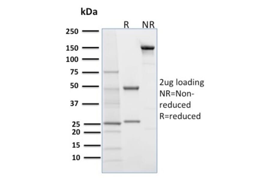 SDS-PAGE - Anti-Desmoglein 1 Antibody [32-2B] - BSA and Azide free (A251551) - Antibodies.com