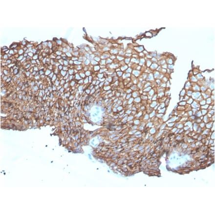 Immunohistochemistry - Anti-Desmoglein 3 Antibody [DSG3/2840] - BSA and Azide free (A251554) - Antibodies.com
