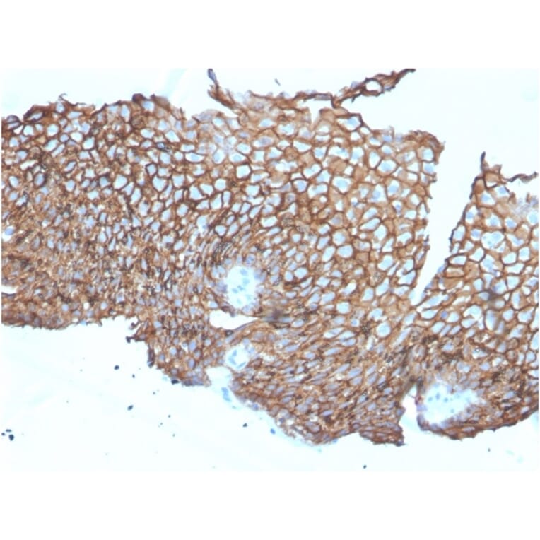 Immunohistochemistry - Anti-Desmoglein 3 Antibody [DSG3/2840] - BSA and Azide free (A251554) - Antibodies.com