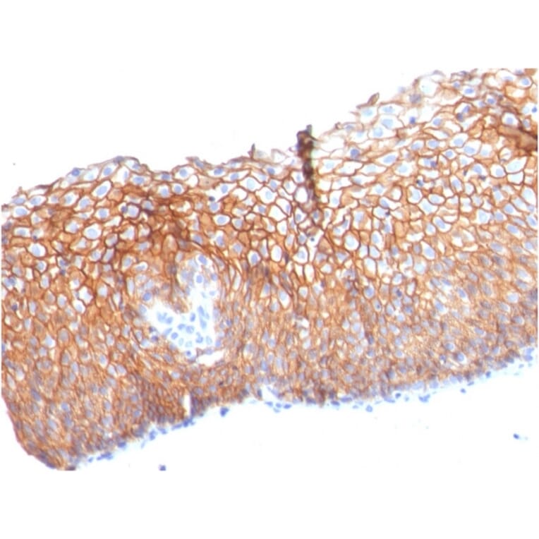 Immunohistochemistry - Anti-Desmoglein 3 Antibody [DSG3/2840] - BSA and Azide free (A251554) - Antibodies.com