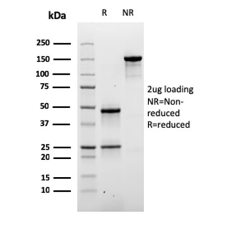 SDS-PAGE - Anti-Desmoglein 3 Antibody [DSG3/2840] - BSA and Azide free (A251554) - Antibodies.com