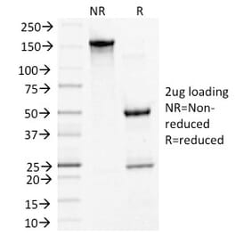 SDS-PAGE - Anti-Desmoglein 3 Antibody [5G11] - BSA and Azide free (A251555) - Antibodies.com